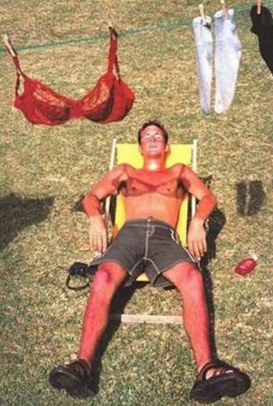 Как не надо загорать (26 фото)