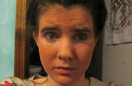 Как не надо загорать (26 фото)