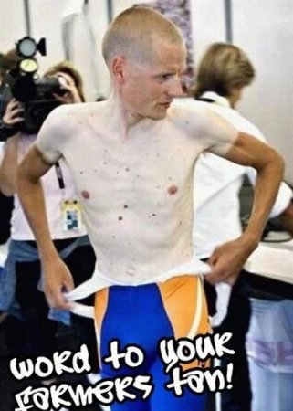 Как не надо загорать (26 фото)