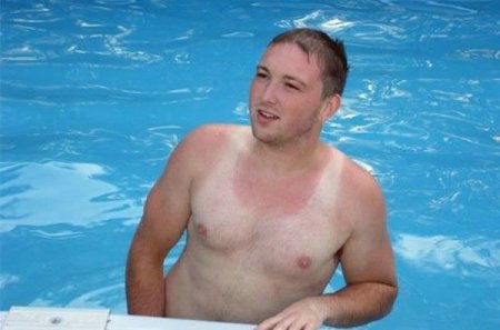 Как не надо загорать (26 фото)