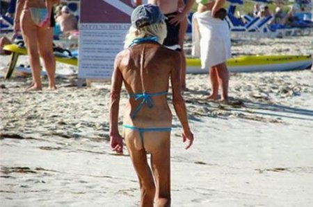 Как не надо загорать (26 фото)