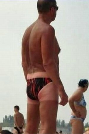 Как не надо загорать (26 фото)