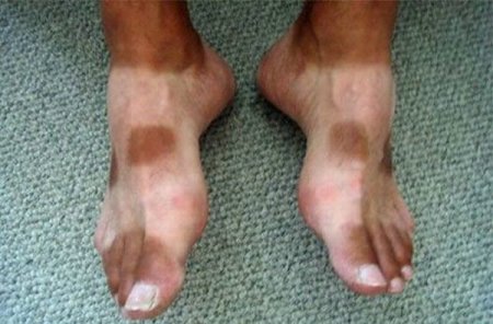 Как не надо загорать (26 фото)