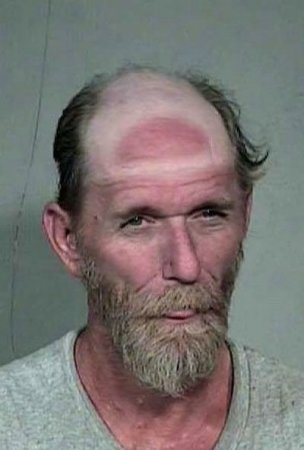 Как не надо загорать (26 фото)