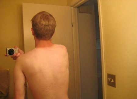 Как не надо загорать (26 фото)