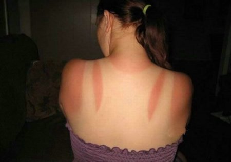 Как не надо загорать (26 фото)