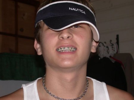 Челюсти (14 фото)