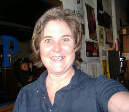 Челюсти (14 фото)