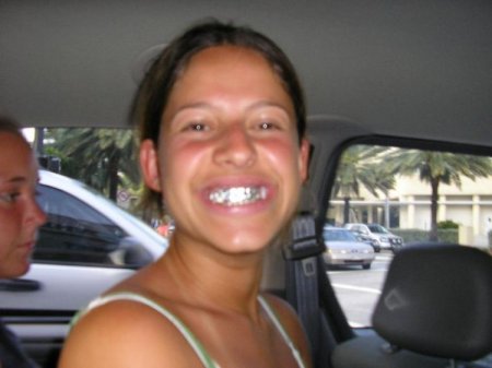 Челюсти (14 фото)