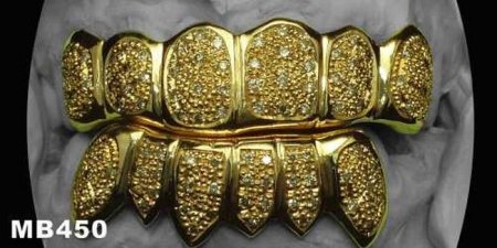 Челюсти (14 фото)