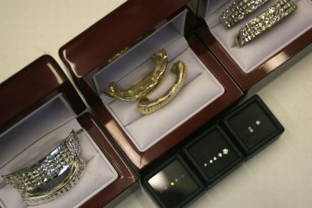 Челюсти (14 фото)