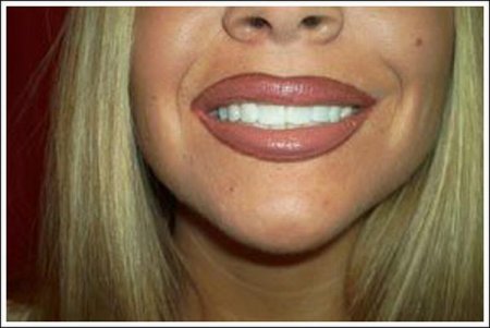 Как блондинка красит губы (10 фото)