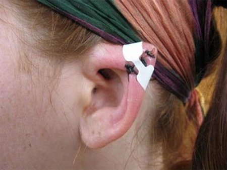 Хит-парад модификаций тела (14 фото)