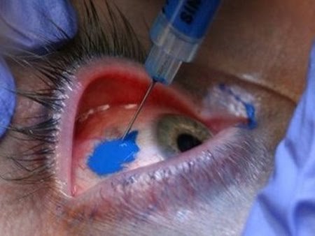 Хит-парад модификаций тела (14 фото)