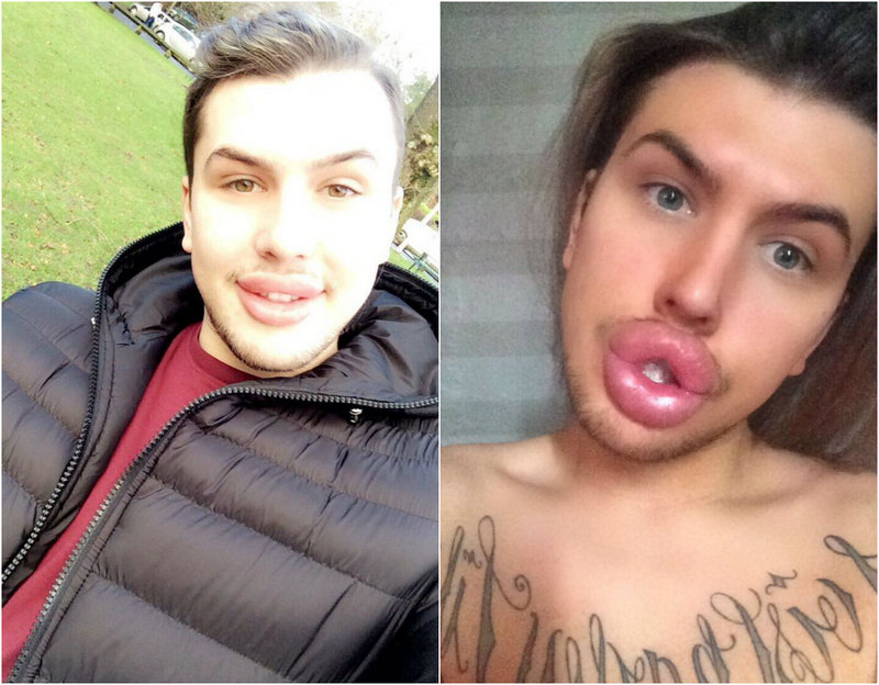 Губастенький поклонник Ким Кардашян