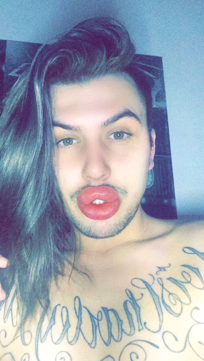 Губастенький поклонник Ким Кардашян