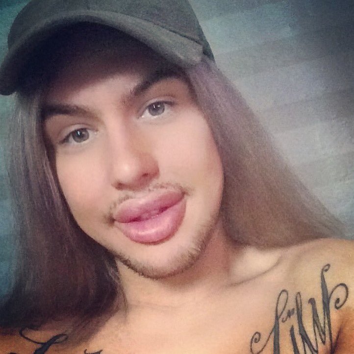 Губастенький поклонник Ким Кардашян