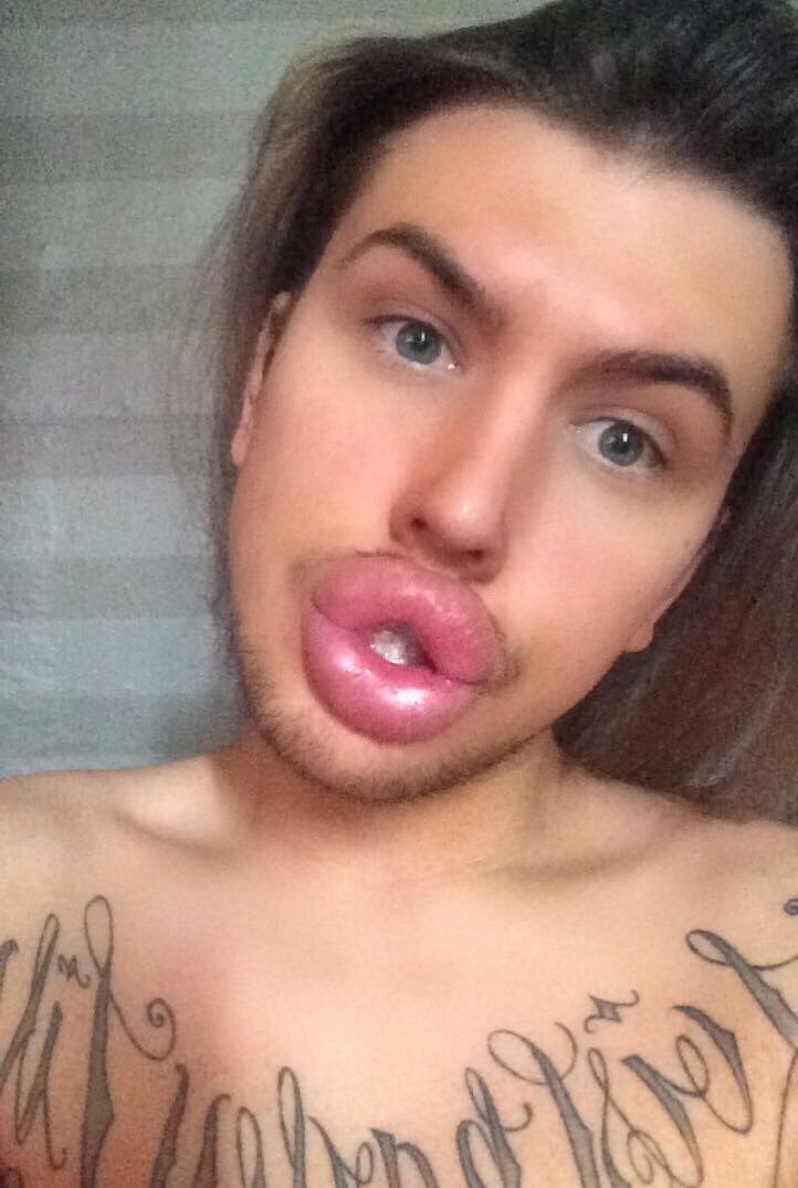 Губастенький поклонник Ким Кардашян