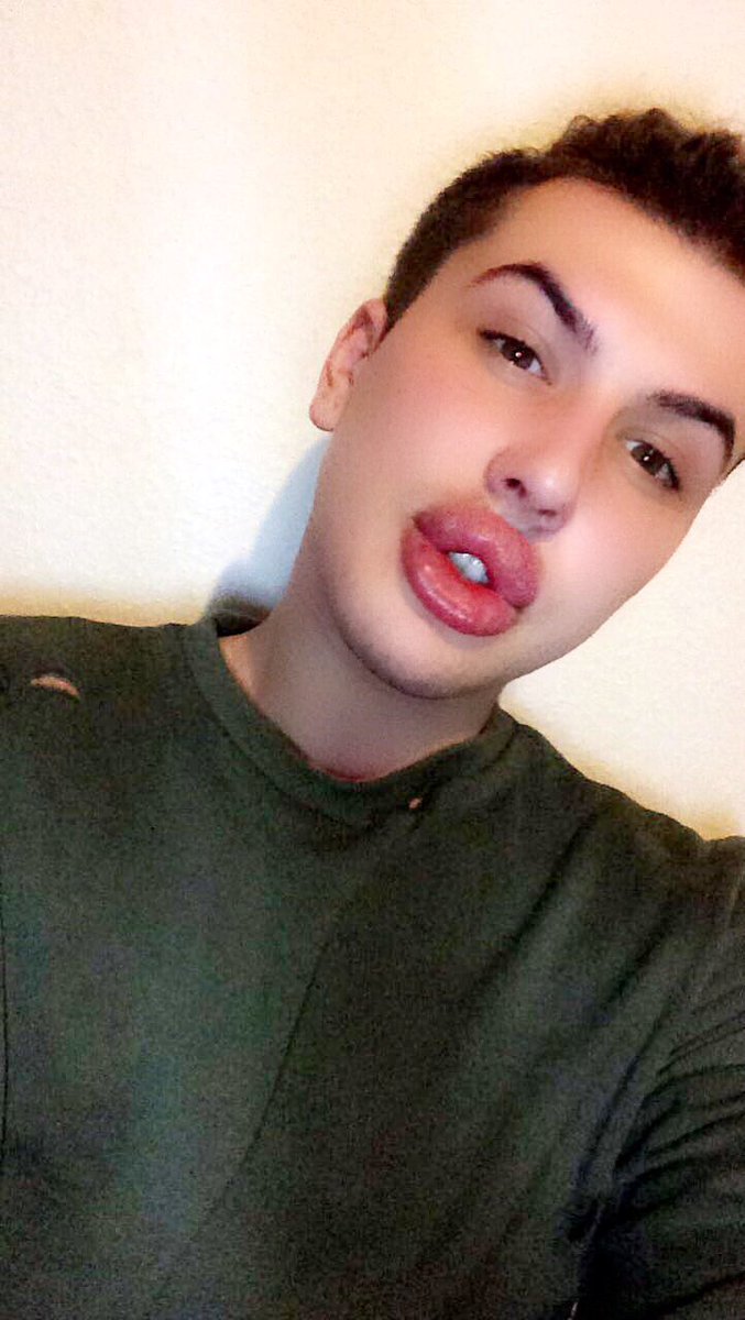 Губастенький поклонник Ким Кардашян