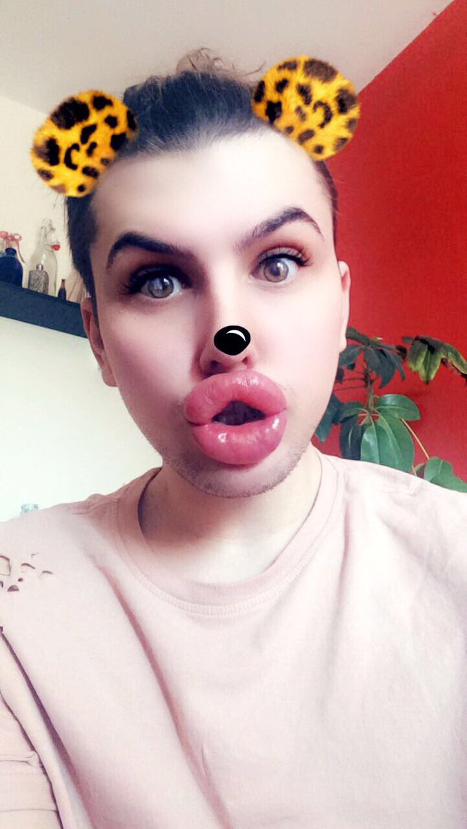 Губастенький поклонник Ким Кардашян