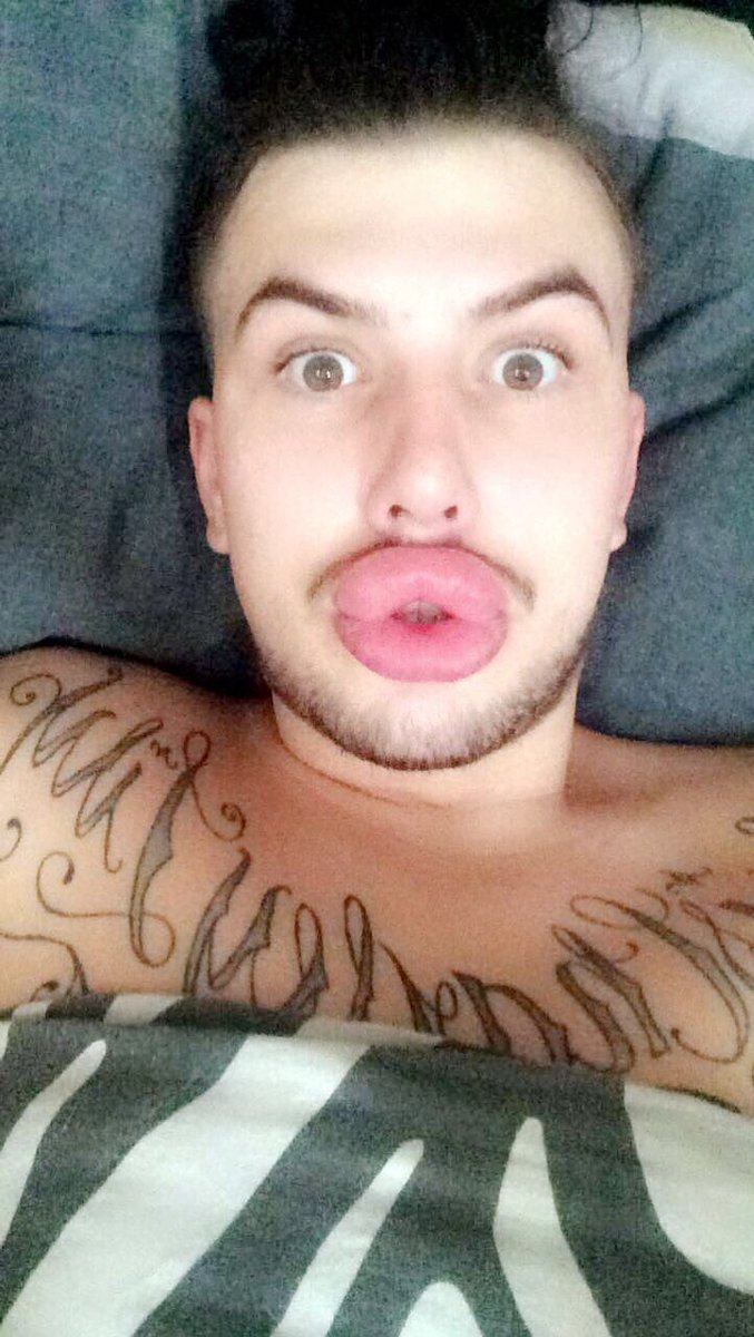 Губастенький поклонник Ким Кардашян