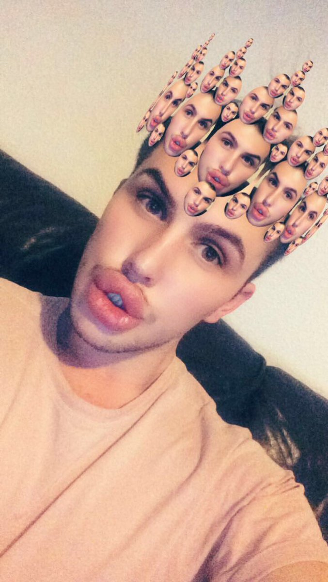 Губастенький поклонник Ким Кардашян