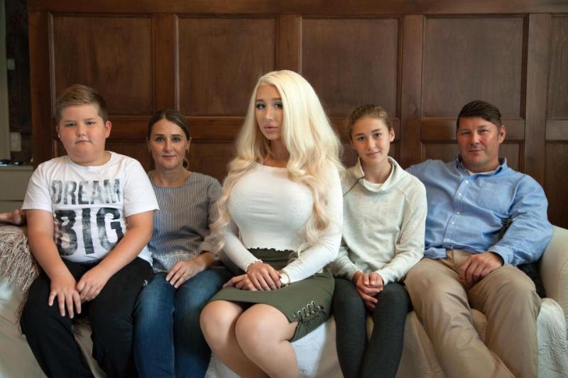 Еле живая Барби продолжает закачивать в себя силикон