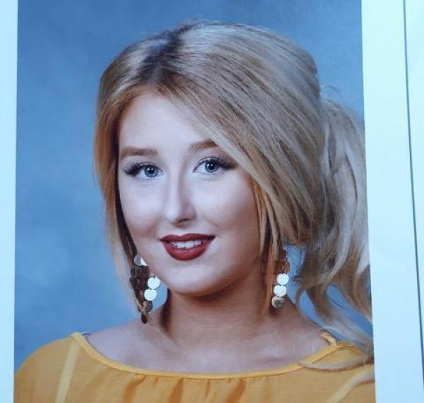 Еле живая Барби продолжает закачивать в себя силикон