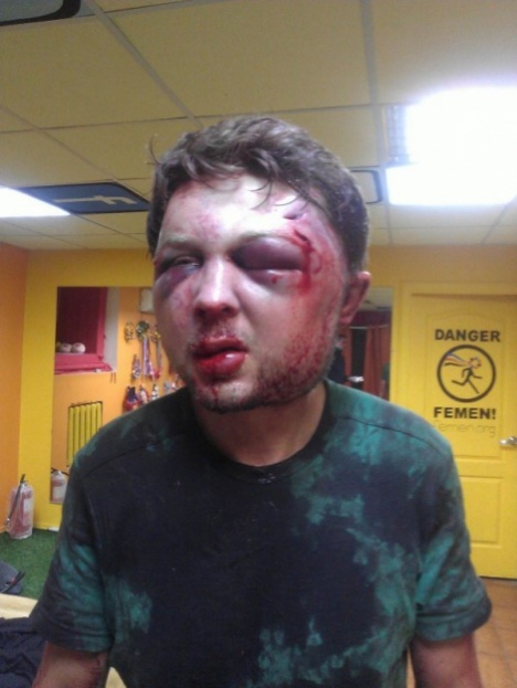 Начали активно прессовать FEMEN