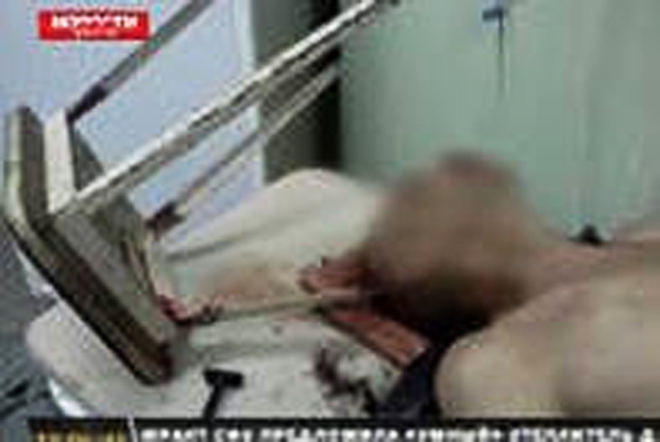 В Красноярске спасли мужчину с табуретом в голове