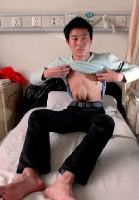 24 года с сердцем в животе