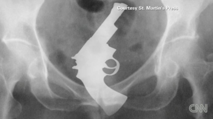 Как это попало в задницу?