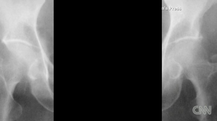 Как это попало в задницу?