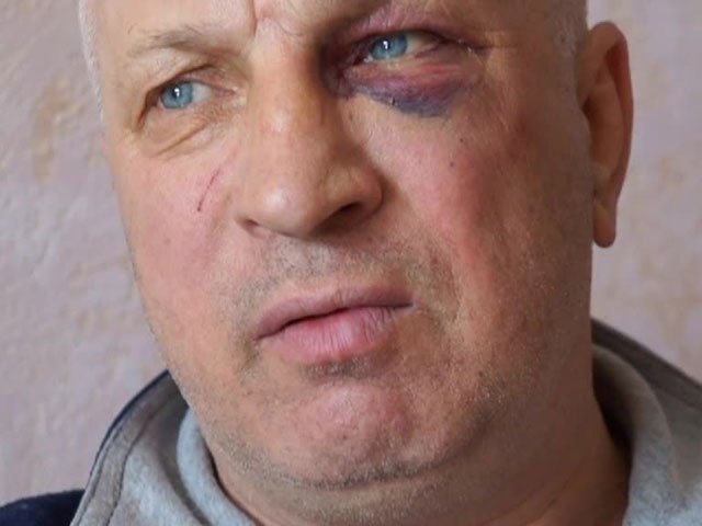 За интервью с "Беркутом" киевского блогера пытали прямо на Майдане