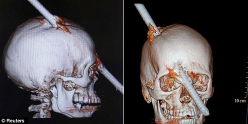 Строительная бразильская жесть
