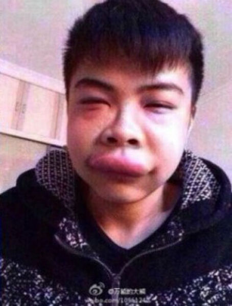 Поцеловал черепаху