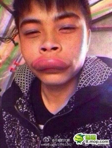 Поцеловал черепаху