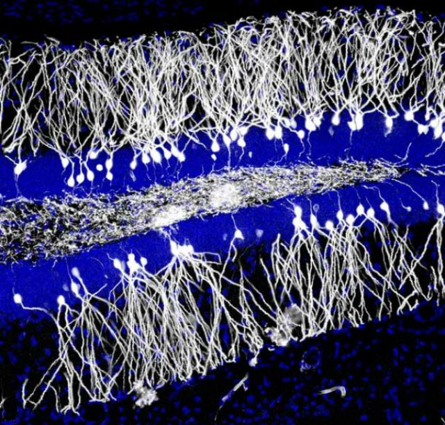 Новые клетки мозга стирают старые воспоминания