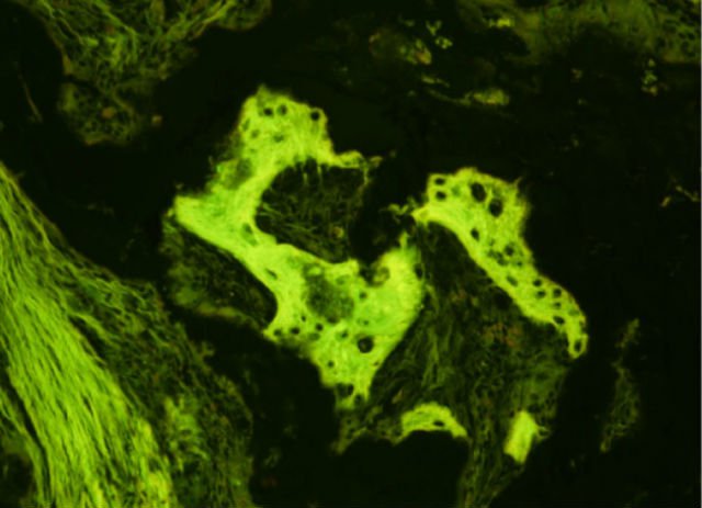 Обезьяны показали, что лечение стволовыми клетками может быть безопасным Обезьяны показали, что лечение стволовыми клетками может быть безопасным