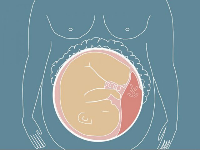 Бактерии, обнаруженные в плаценте, защищают здоровье плода Бактерии, обнаруженные в плаценте, защищают здоровье плода