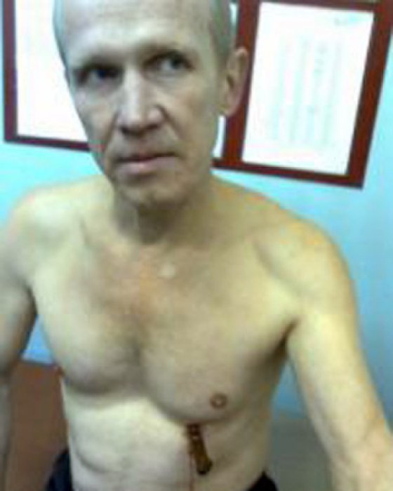 Воткнул себе нож в грудь и лёг спать