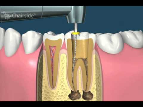 Что творит стоматолог у вас во рту?