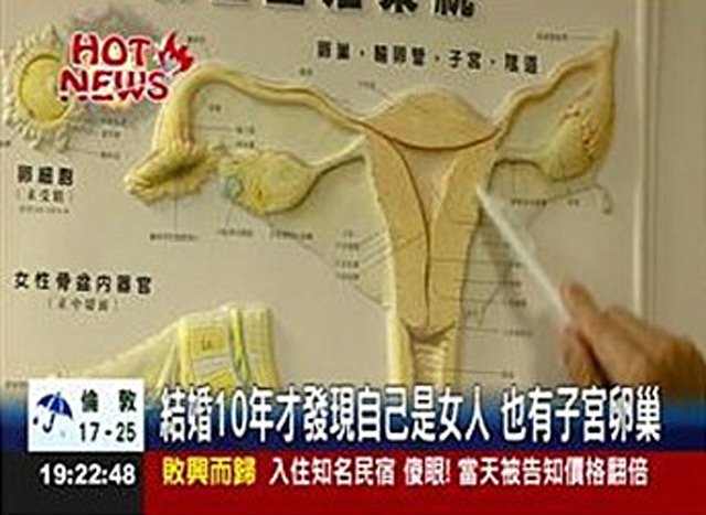 Женатый мужчина пришёл к врачу с жалобами на боли в животе и узнал, что он женщина