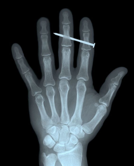 Вот ваш снимок, но вы только не волнуйтесь! (22 фото)