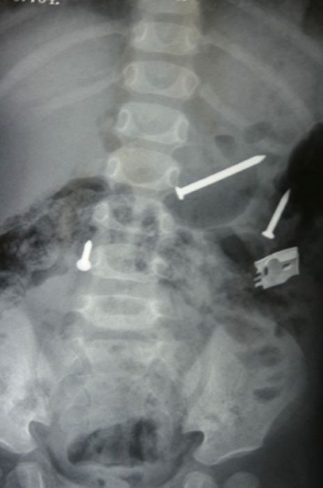 Вот ваш снимок, но вы только не волнуйтесь! (22 фото)