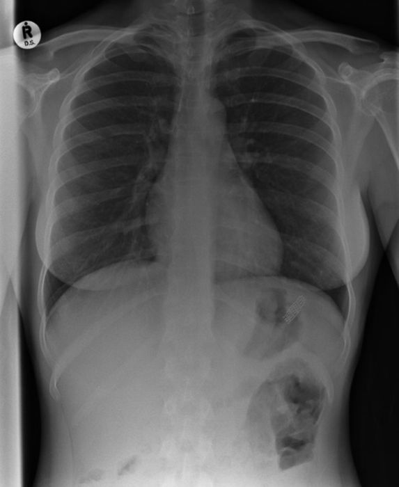 Вот ваш снимок, но вы только не волнуйтесь! (22 фото)