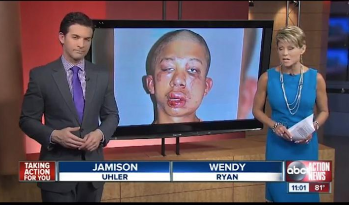 Злой папуля изуродовал извращенца