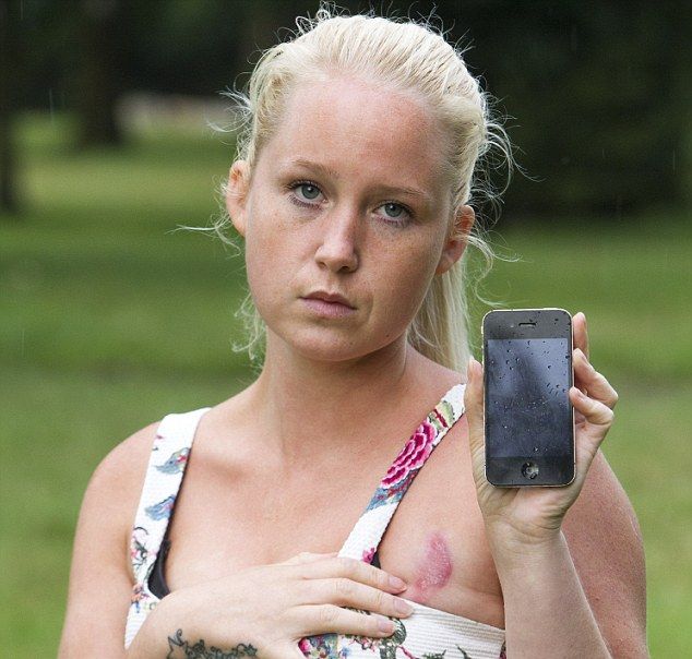 iPhone прожег дыру в груди девушки