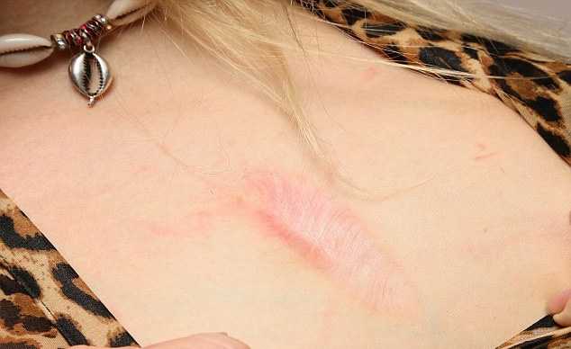 За сутки женщина 29 раз побывала на том свете