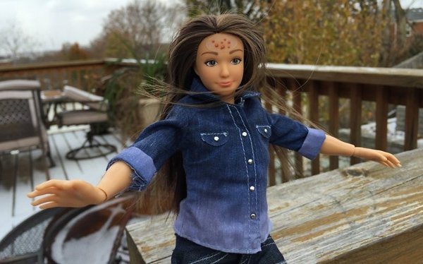 В США создали "конкурентку" Барби с прыщами и целлюлитом